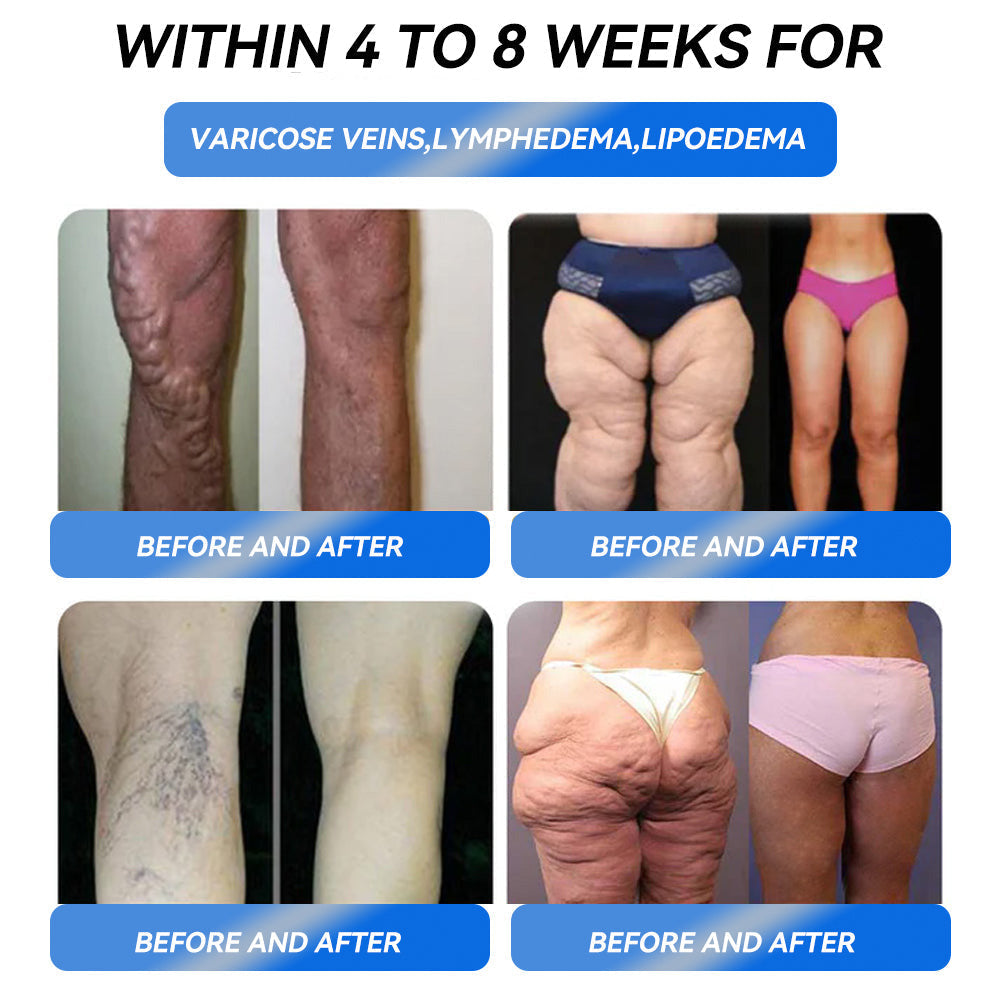 IFMAGIC® GLP-1 Pro Weight Loss Oral Solution✅Recommended doctors for obesity in the USA👩‍⚕️Suitable for obesity, cardiovascular diseases, diabetes, sleep apnea, high cholesterol and blood lipids, joint problems, and various other conditions💦