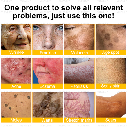 💐🌟💐Made and Shipped from UK ✨  Bee Venom Skin Restoration Cream 🔥 LAST DAY 80% OFF