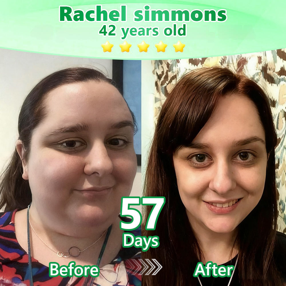 💪 𝐎𝐟𝐟𝐢𝐜𝐢𝐚𝐥 Australia 𝐂𝐞𝐫𝐭𝐢𝐟𝐢𝐞𝐝 👩‍⚕️ 𝐋𝐨𝐭𝐦𝐚𝐲® GLP-1 6-in-1 Oral Liquid  Supports weight management, heart & vascular health, blood sugar balance, sleep quality, joint flexibility, and overall wellbeing