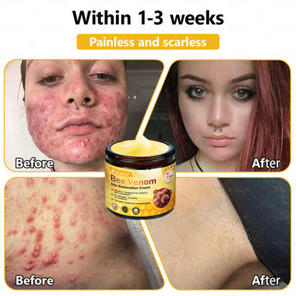 💐🌟💐Made and Shipped from UK ✨  Bee Venom Skin Restoration Cream 🔥 LAST DAY 80% OFF