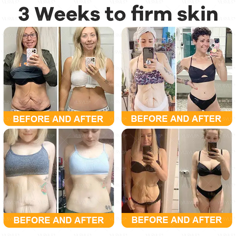 💐🌟💐Made and Shipped from UK ✨  Bee Venom Skin Restoration Cream 🔥 LAST DAY 80% OFF