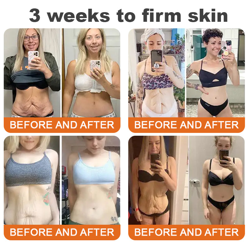 Made and Shipped from USA✨TLOPA® Botox Bee Venom Firming Serum Stick(🔥LAST DAY 70% OFF)💄