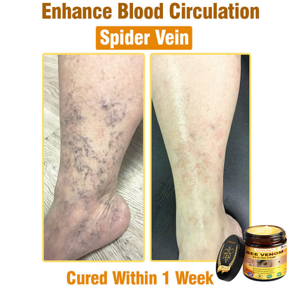 LOVILDS™ Bee Venom All-in-One Cream US Dermatologist Approved