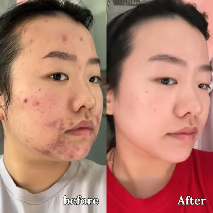 💖Summer Sale 49% OFF🔥Organic Grass-Fed Beef Tallow Balm with Raw Honey