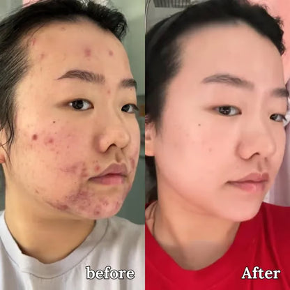 💖Summer Sale 49% OFF🔥Organic Grass-Fed Beef Tallow Balm with Raw Honey