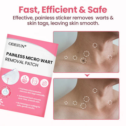 Painless Micro Wart Removal Patch