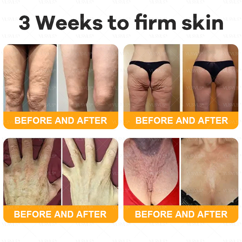 💐🌟💐Made and Shipped from UK ✨  Bee Venom Skin Restoration Cream 🔥 LAST DAY 80% OFF