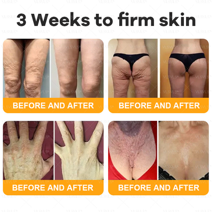 💐🌟💐Made and Shipped from UK ✨  Bee Venom Skin Restoration Cream 🔥 LAST DAY 80% OFF