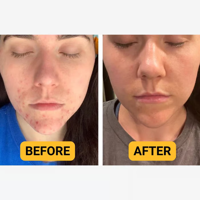 💖Summer Sale 49% OFF🔥Organic Grass-Fed Beef Tallow Balm with Raw Honey