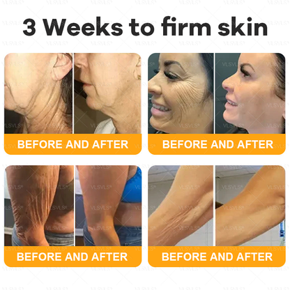 💐🌟💐Made and Shipped from UK ✨  Bee Venom Skin Restoration Cream 🔥 LAST DAY 80% OFF