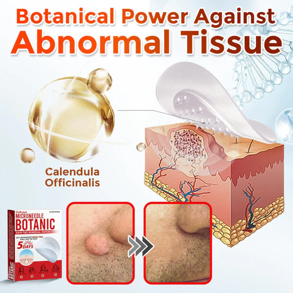 DELHAVE® MicroNeedle Botanic Skin Tag Removal Patch 🇺🇸 Made in the USA