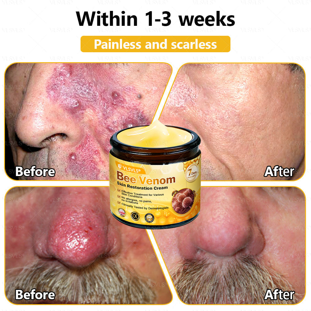 💐🌟💐Made and Shipped from UK ✨  Bee Venom Skin Restoration Cream 🔥 LAST DAY 80% OFF