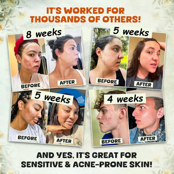 💖Summer Sale 49% OFF🔥Organic Grass-Fed Beef Tallow Balm with Raw Honey