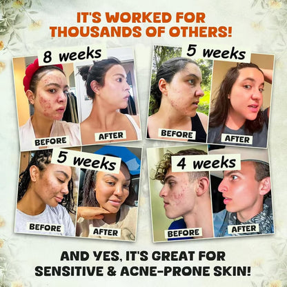 💖Summer Sale 49% OFF🔥Organic Grass-Fed Beef Tallow Balm with Raw Honey