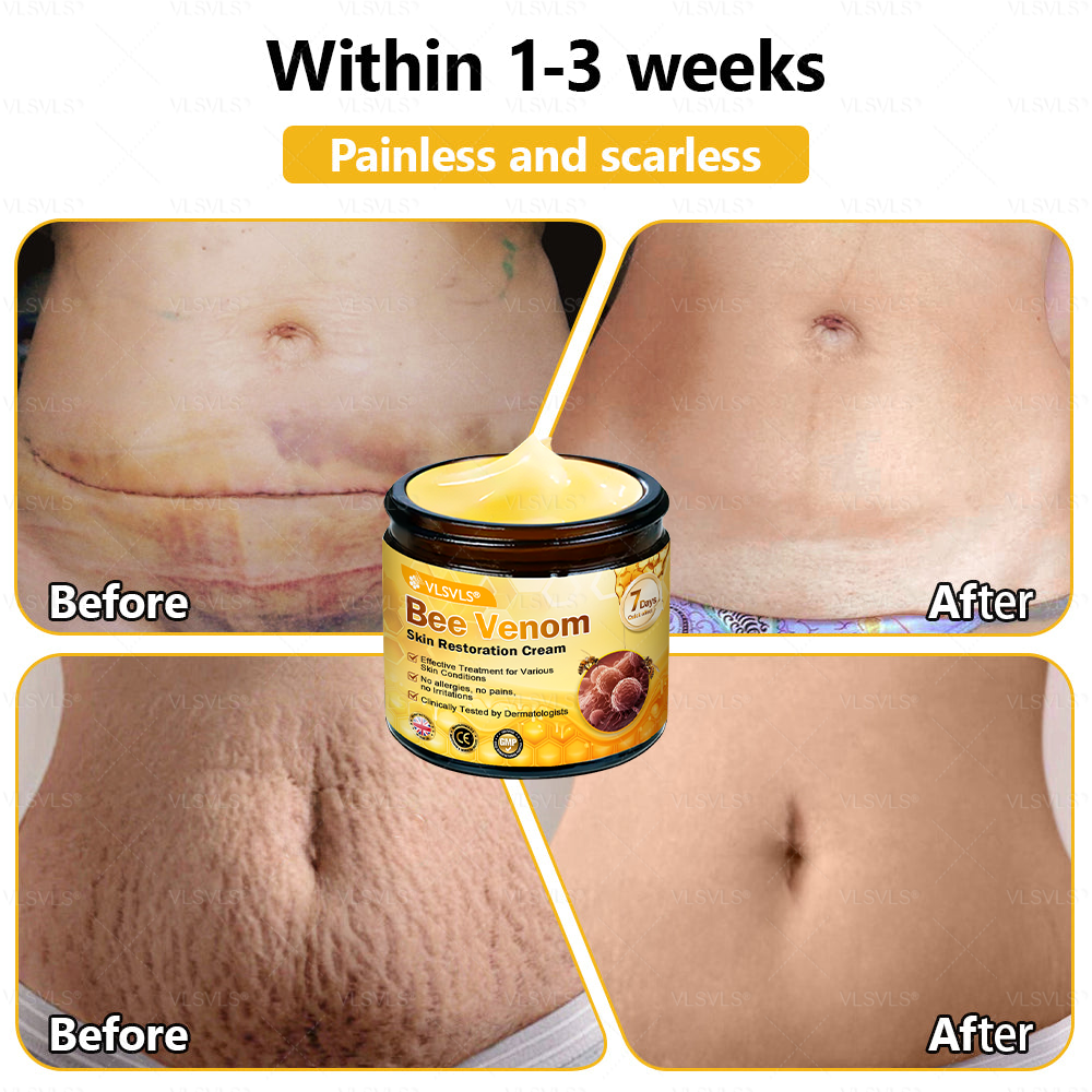 💐🌟💐Made and Shipped from UK ✨  Bee Venom Skin Restoration Cream 🔥 LAST DAY 80% OFF