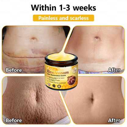 💐🌟💐Made and Shipped from UK ✨  Bee Venom Skin Restoration Cream 🔥 LAST DAY 80% OFF