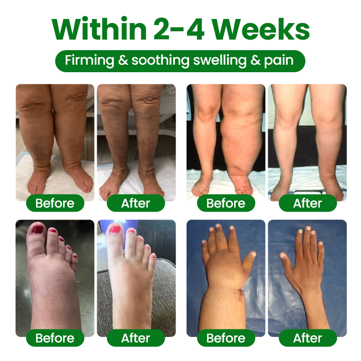 LAOZIKTM VenoSoothe Leg Relief Spray