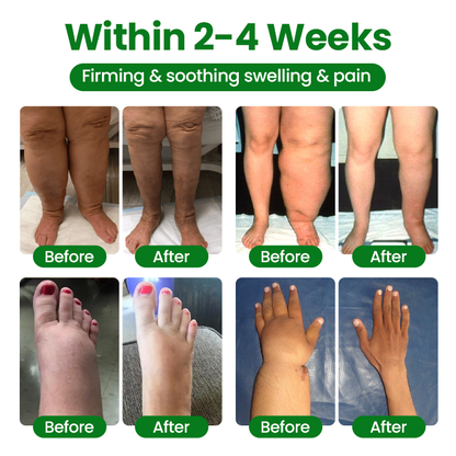 LAOZIKTM VenoSoothe Leg Relief Spray