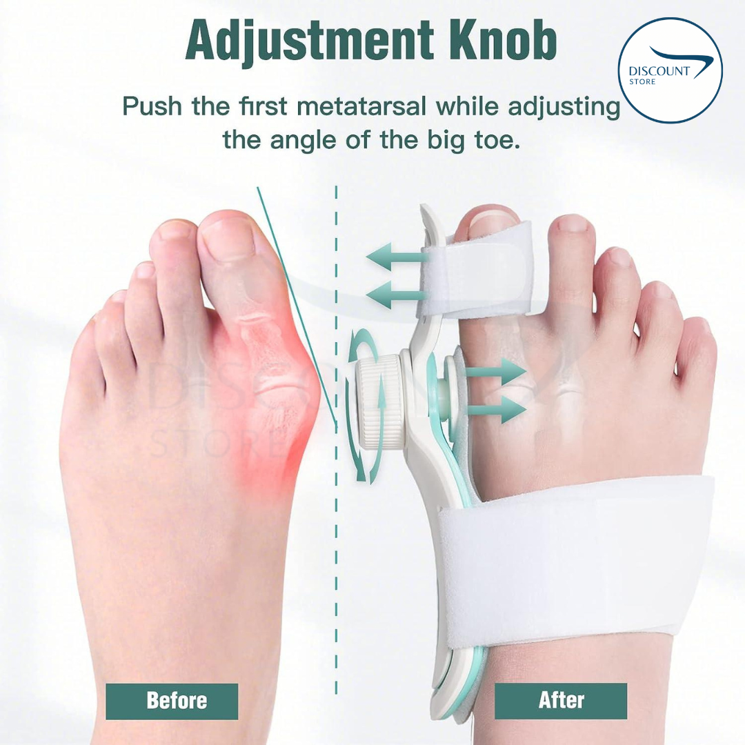 Pain Relief Bunion Toe Corrector - (IMPORTED)