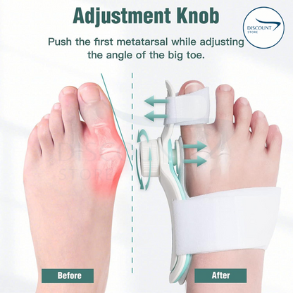 Pain Relief Bunion Toe Corrector - (IMPORTED)