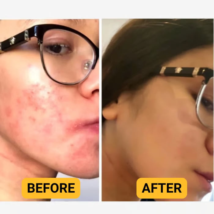 💖Summer Sale 49% OFF🔥Organic Grass-Fed Beef Tallow Balm with Raw Honey