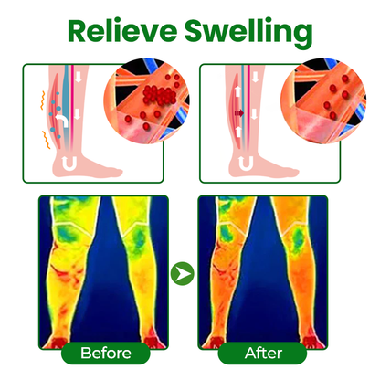 LAOZIKTM VenoSoothe Leg Relief Spray