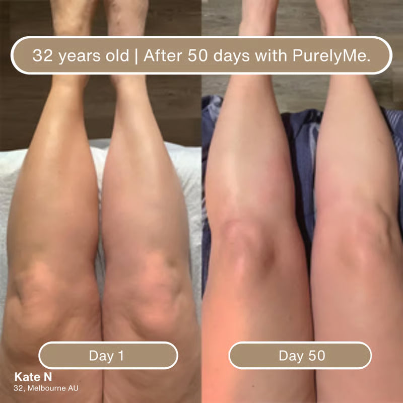 🏆Flash Sale⚡Anti-Cellulite Massage Oil