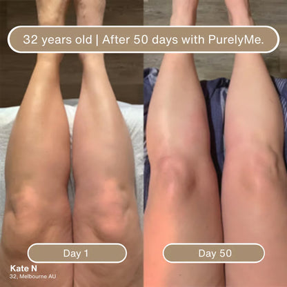 🏆Flash Sale⚡Anti-Cellulite Massage Oil