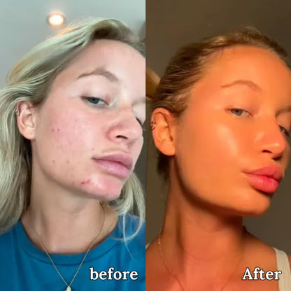 💖Summer Sale 49% OFF🔥Organic Grass-Fed Beef Tallow Balm with Raw Honey