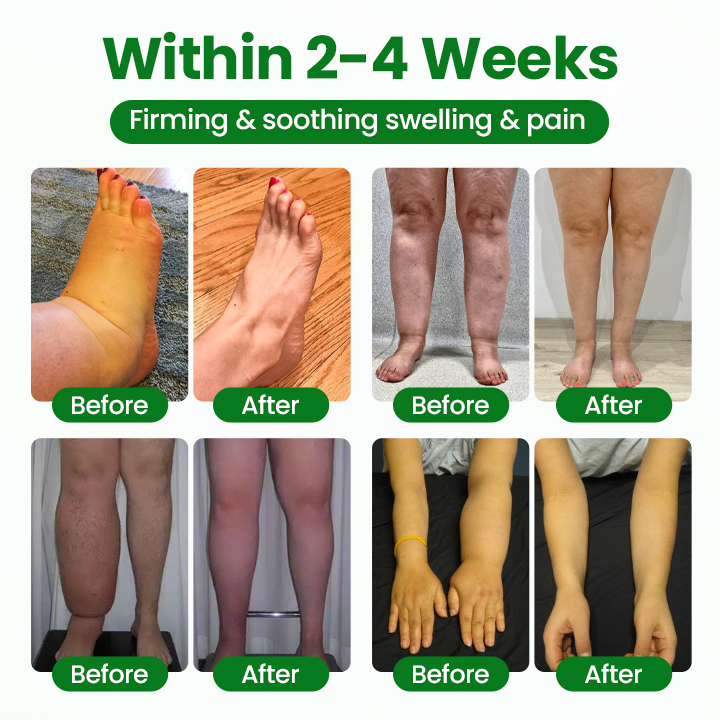 LAOZIKTM VenoSoothe Leg Relief Spray