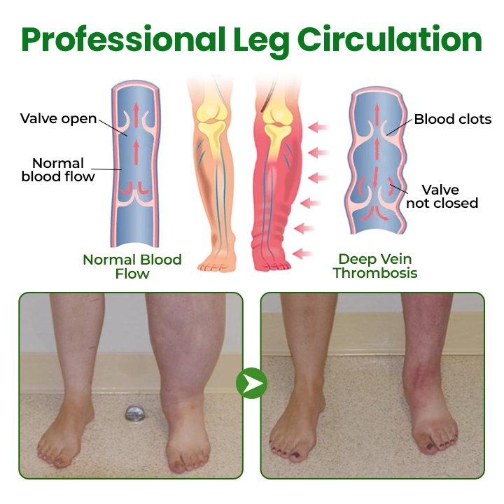 LAOZIKTM VenoSoothe Leg Relief Spray