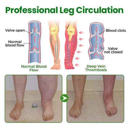 LAOZIKTM VenoSoothe Leg Relief Spray